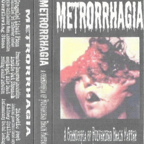 Metrorrhagia : A Cornucopia of Pulverized Brain Matter Metrorrhagia : A Cornucopia of Pulverized Brain Matter